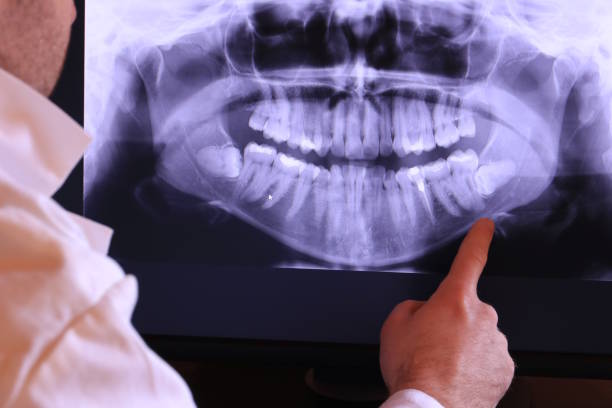 Best Emergency Treatment for Toothache in Magalia, CA