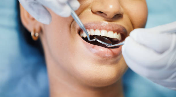 Best Emergency Broken Tooth Repair in Magalia, CA